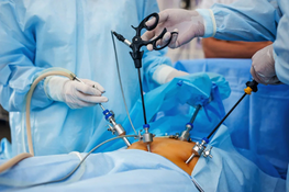 Laparoscopic Minimally Invasive Surgery